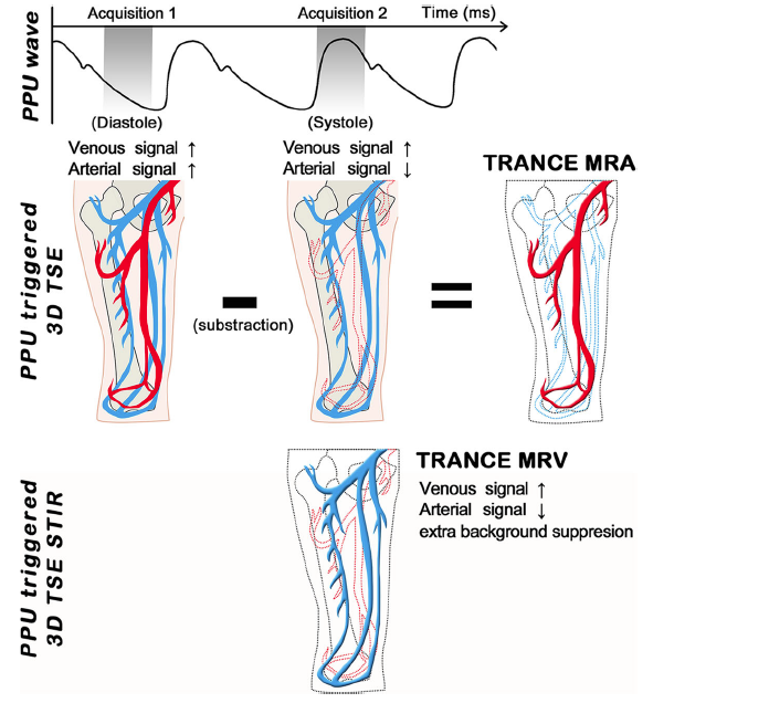 新診斷技術研發 TRANCE MR FOR LEG VENOUS DISEASE: 原著論文發表於BMC MEDICAL IMAGING