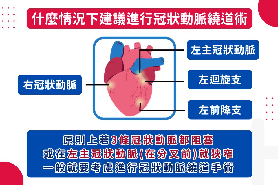 冠狀動脈繞道術