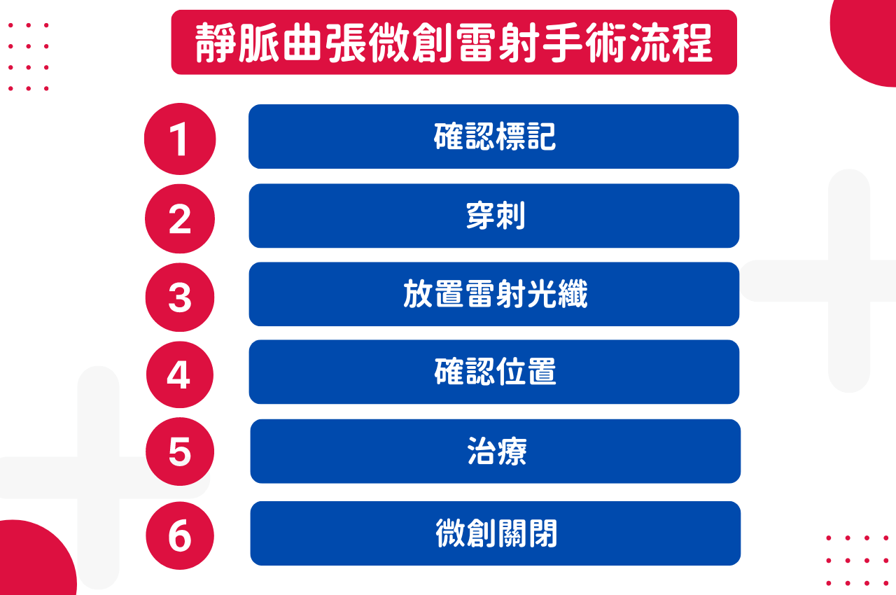 靜脈曲張雷射知多少？了解微創雷射費用與後遺症問題，安心手術沒煩惱