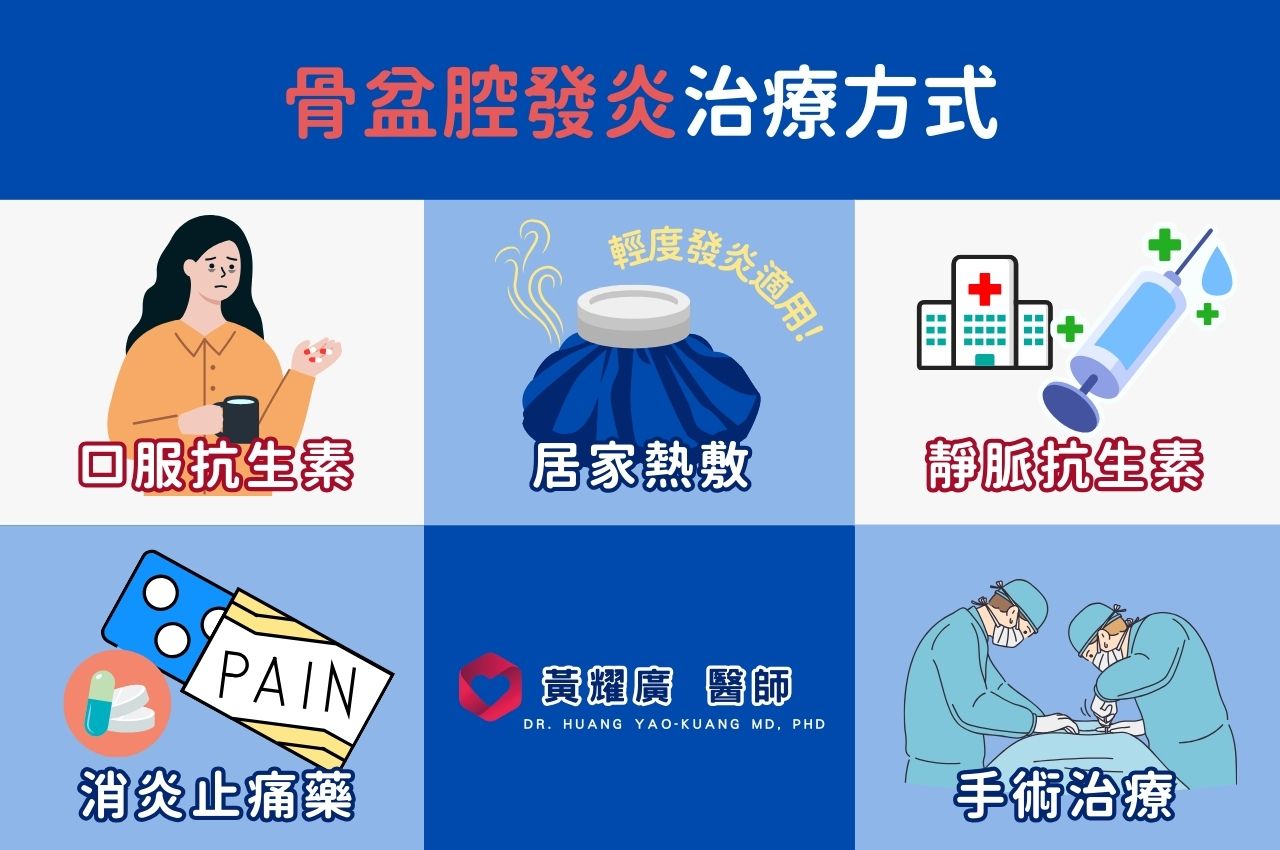 骨盆腔發炎治療方式