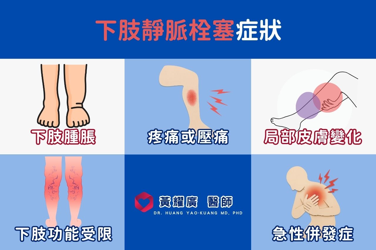 下肢靜脈栓塞症狀